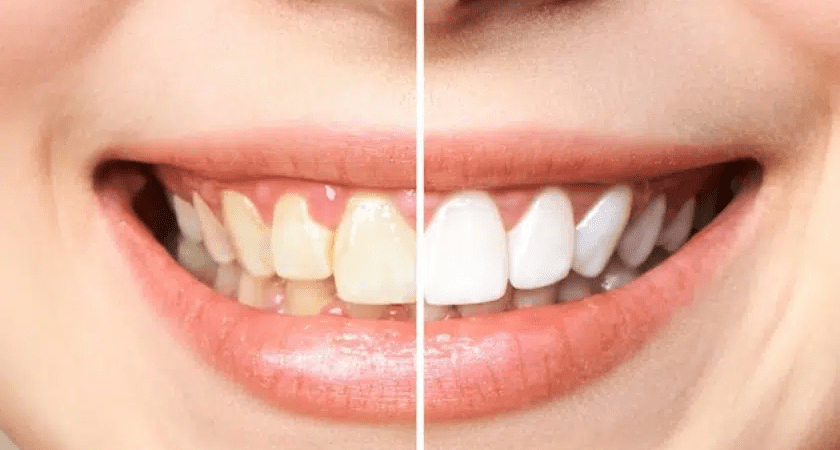 Pan Dentistry