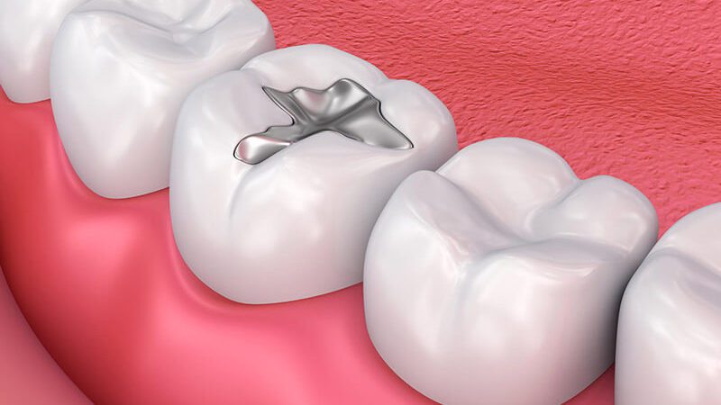 Pan Dentistry