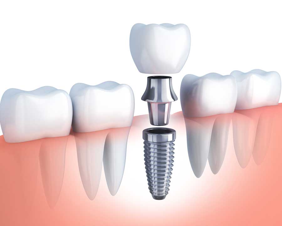 Pan Dentistry