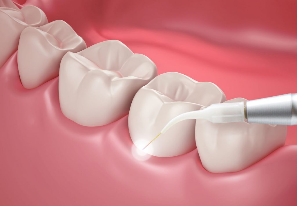Pan Dentistry