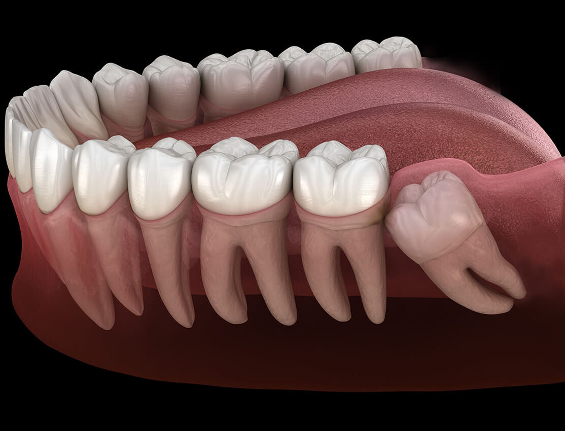 Pan Dentistry