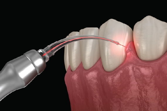Pan Dentistry – Family Dentistry & Dental Implant Specialist in Issaquah, WA